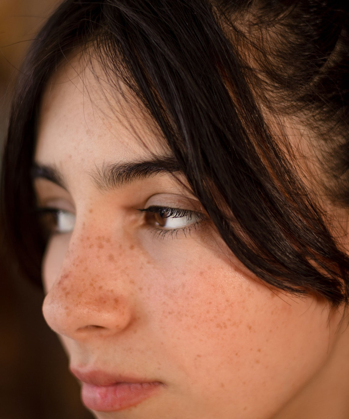 Pigmentation